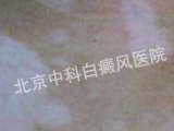 ҽԺ֢ܰ״